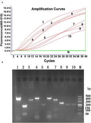 Establishment and Application of a Real-Time Recombinase Polymerase Amplification Assay for the Detection of Avian Leukosis Virus Subgroup J